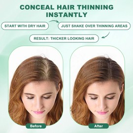 Hair Fibers (12g), Hair Fibers for Thinning Hair, Hair Building Fibers, Hairpiece Filler, Increase Hair Density, Styling Powder for Women & Men, Hair Makeup, Premium Formula Thickening (DARK BROWN)