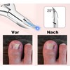 Professional Nail Clippers for Thick Toenails and Fingernails, Professional Ingrown
