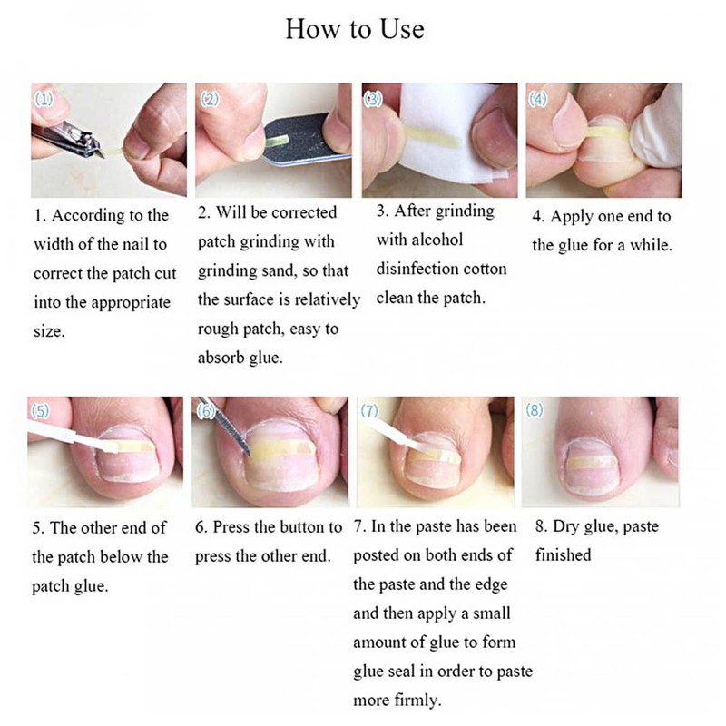 6 in 1 set Ingrown Toe Nail Fixer Pedicure Toenail