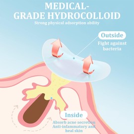 Hydrocolloid Patches, (80 Patches) Acne Pimple Spot Patch for Large Zit Breakoutse, Face Chin and Body Mighty Dots for Spots Treatment with Tea Tree & Calendula Oil Hydrocolloid