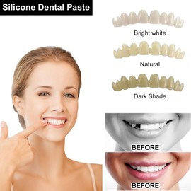 False Teeth Veneers, Teeth for Attaching, Prostheses Teeth Cosmetic Veneers Teeth Set, Veneer Teeth Cosmetic Tooth Cover Fake, Provisional Teeth, Instant Dentures