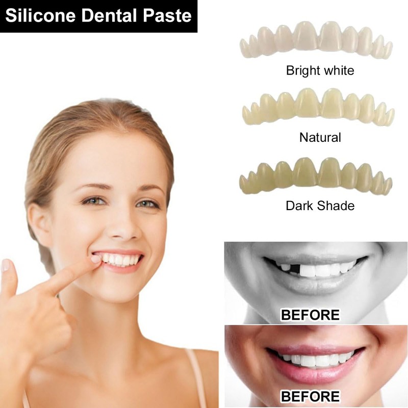 False Teeth Veneers, Teeth for Attaching, Prostheses Teeth Cosmetic Veneers
