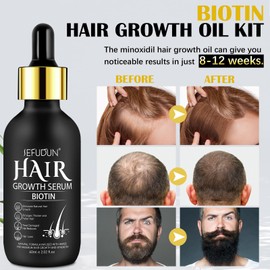 Hair Growth Serum with Biotin for Women, Beard & Hair Growth Oil for Loss Treatment, Hair Thinning, Natural Hair Growth Longer Fuller Healthier Hair, with 0.25mm Roller