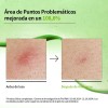 Kit Anua Heartleaf Skincare Coreano Limpieza Profunda Poros