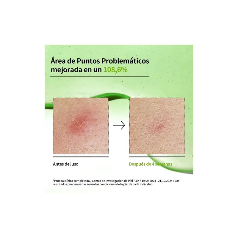 Kit Anua Heartleaf Skincare Coreano Limpieza Profunda Poros