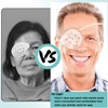 FSJLT 2pcs Clear Eye Shield for Cataract Surgery Hard Vented