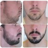 Crecer La Barba Bigote Cejas Profesional Y Natural Novocrin