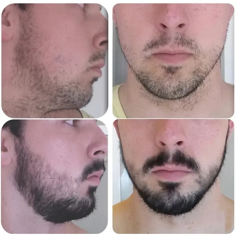 Crecer La Barba Bigote Cejas Profesional Y Natural Novocrin