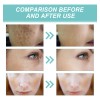 Be Eliminador De Manchas Oscuras For Rostro Y Cuerpo, 2