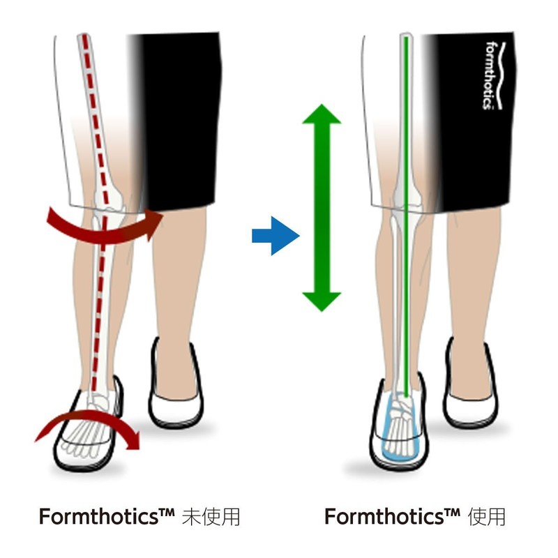 Formthotics Dress Fashion 3/4 Insoles (Dress Fashion 3/4) - charcoal,