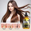 Landrain 30 ml Hair Growth Serum, Anti Hair Loss Hair