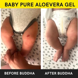 Buddha Natural Baby Aloe Vera Gel - Ayush Certified - Raw Pure Aloe Vera - Get Hydrated And Rash Free Skin For Your Newborn'S Skin (100 G (Pack Of 1))