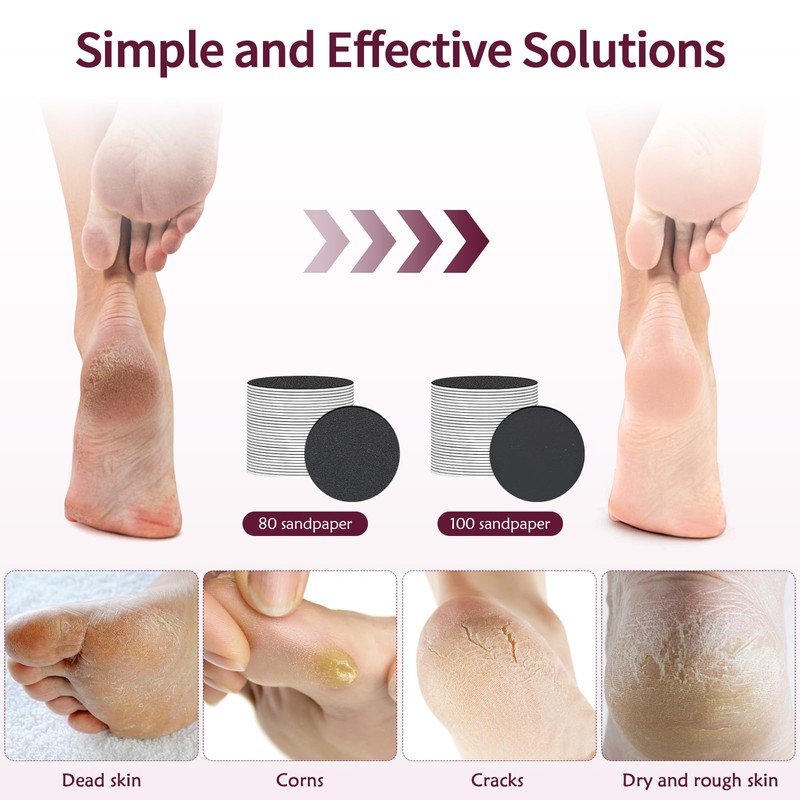 Jellybibo Electric Foot File Hard Skin Remover, 12 Speeds Powerful