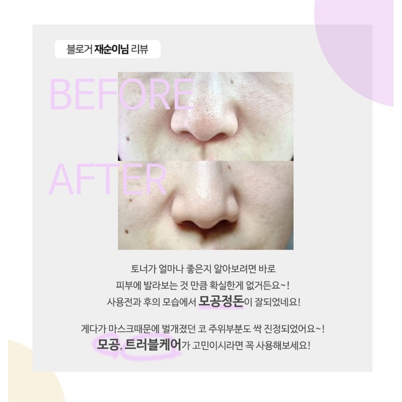 Bio peeling herbal lotion problematic skin toner 200ml + trial