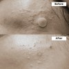 NINELESS [NINELESS]Azelaic Acid Serum Duo Set (Free Gift : Azelaic