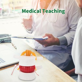 DEWIN 1:1.5 Human Herniated Disc Medical Demonstration Model, Medical Demonstration Model of Lumbar Spine, Clinical Teaching