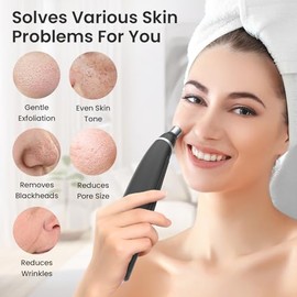 Unoisetion- Máquina de microdermoabrasión con diamante, dispositivo de dermoabrasión facial portátil, herramienta de microdermoabrasión portátil con 12 puntas de diamante, eliminación de puntos negros