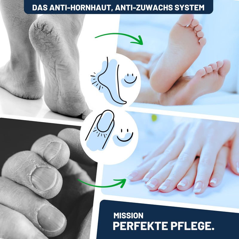Mr. Fuss Solution No. 1-500 ml Strong Softening Callus Remover