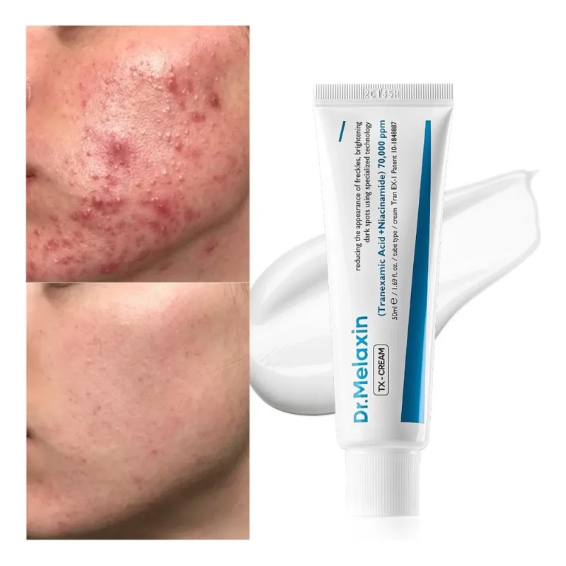 Crema Facial Despigmentante Y Anti Manchas Pack X2 Pa