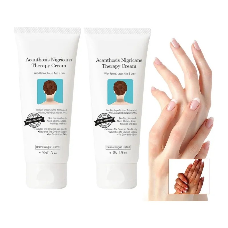 Crema Correctora Manchas Oscuras Hiperpigmentación, Vingtank