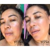 Crema Despigmentante Quita Manchas Acné Paño Vitíligo De 30g