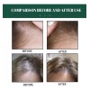 Serum Concentrado Gengibre Natural Crecimiento Cabello 30ml