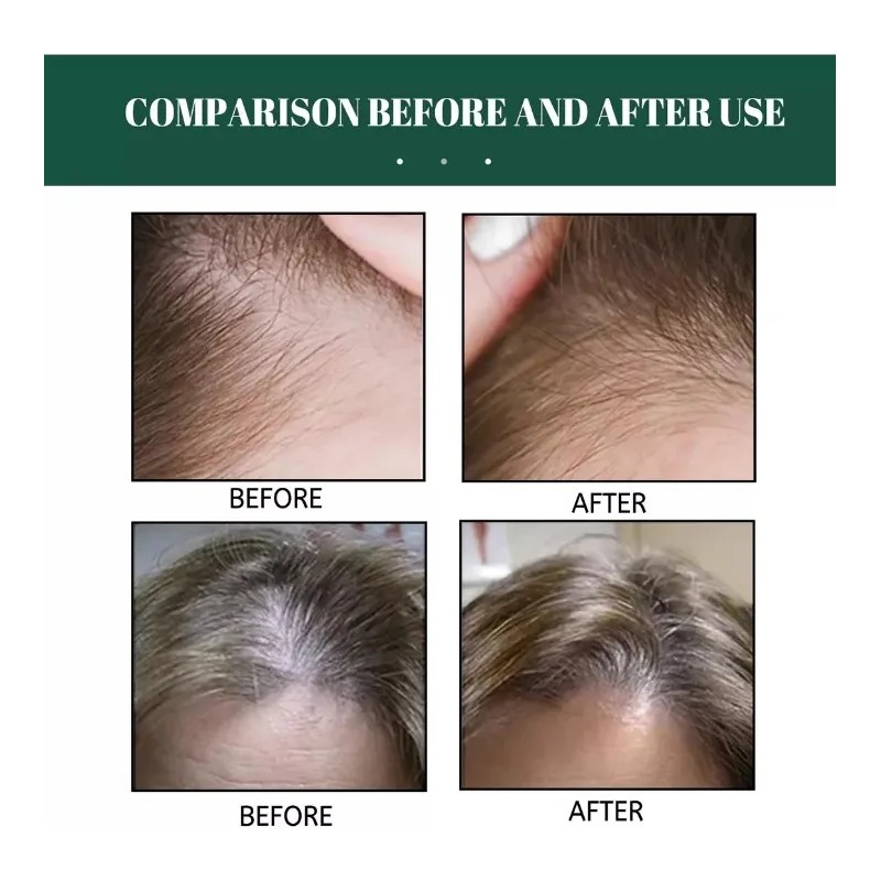 Serum Concentrado Gengibre Natural Crecimiento Cabello 30ml