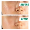 Nightingale Tea Tree Calming Pad, Tea Tree & Facial Toner
