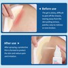 No Sting Ostomy Barrier Spray - Skin Barrier Film for