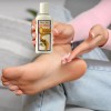 2 Pzas Crema Contra Pie De Atleta Antihongos 60ml Bella