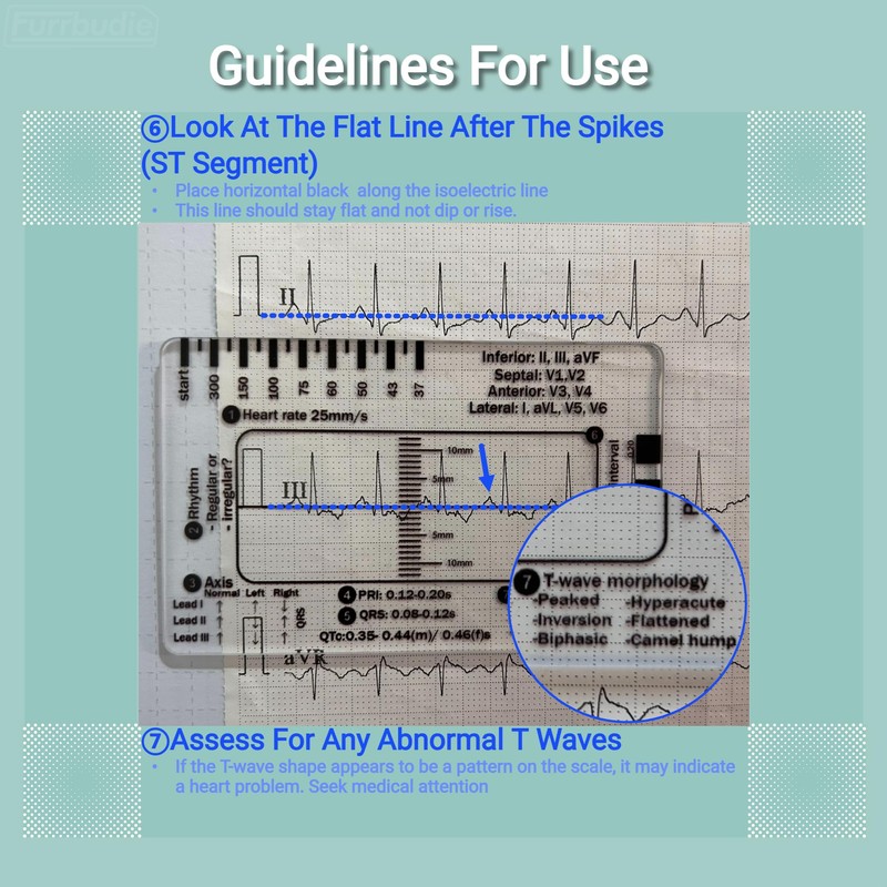 ECG 7 Step Ruler 2pcs ECG Ruler Plastic Ruler Measuring