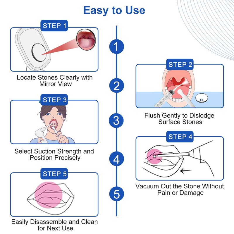 Tonsil Stone Vacuum Remover with LED Light Upgraded Electronic Oral
