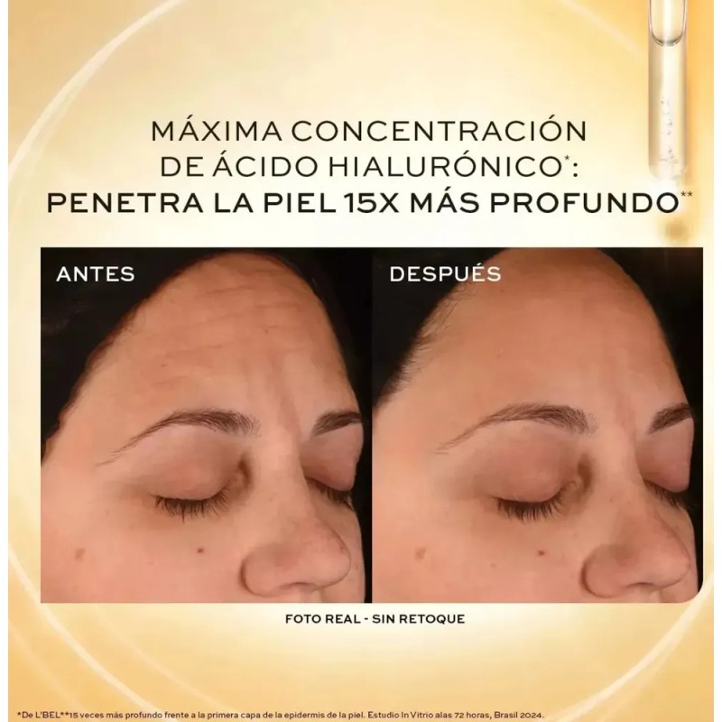Suero Reductor De Arrugas 15% De Acido Hialuronico