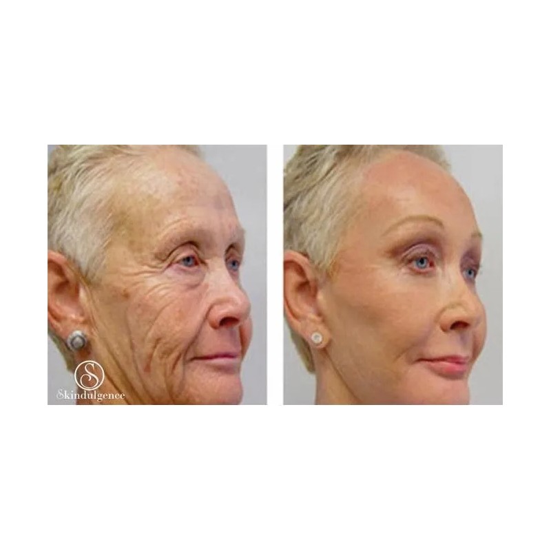 Skindulgence Mascarilla Rejuvenece En 30 Minutos