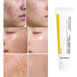 Crema Facial Aclarante Para Manchas Y Poros 35 G