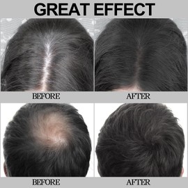 Apooliy Hairline Powder,Hair Shadow for Thinning Hair for Women and Men,Cover Gray Hair Root Touch Up Powder,Hair Shading Filler