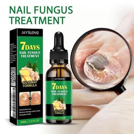 JAYSUING 7 Days Nail Care Serum Ginger Extract Nail Essence, Ginger Nail Treatment, Multi-Purpose Nail Repair, Nail Nutrient Oil Strengthener Oil - Specification: 1 PCS