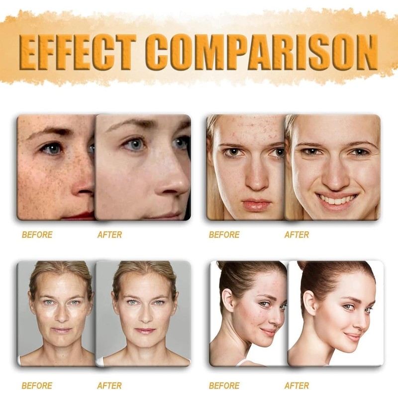 Jabón de Ácido Kójico con Cúrcuma y Limón, Barra Facial