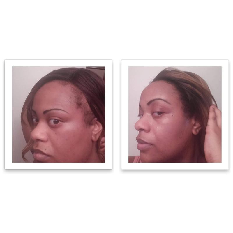 Caboki 10X Hair Powder - Trial Size:_Medium Brown