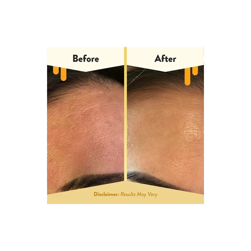 Eczema Honey Crema Facial Concentrada De Renovacin Nocturna