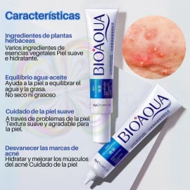 Cuidado Facial Crema Eliminación De Acné Senana Marina 1pz                                                                                            