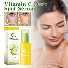 Vitamin C Dark Spot Serum - Green Tangerine Vitamin C Serum - Vitamin-C Gesichtsserum für Frauen - Pigmentflecken Entferner Gesicht Essenz - Glatte die Haut Feuchtigkeitsspendend Serum Gesichtspflege
