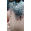 Shampo Sólido Anticaspa - Psoriasis Cinnafix
