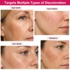 O.SECERT Arbutin 7% + Tranexamic Acid 4% Dark Spot Corrector