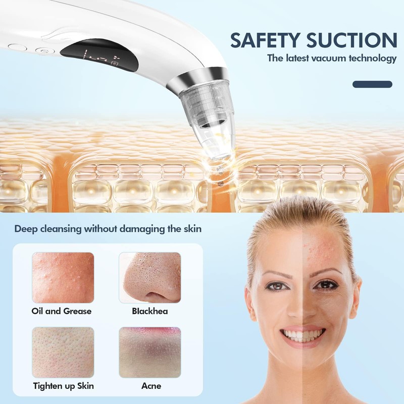 Blackhead Remover Pore Vacuum, Upgraded Black Head Remover for Face,