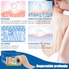 parches de silicona para cicatrices,cinta de silicona para cicatrices, elimina