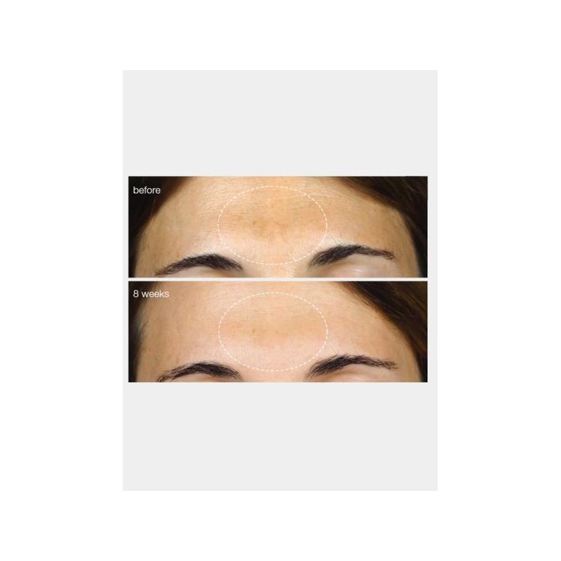 Dermalogica PowerBright Dark Spot Serum 30ml