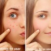 Cebo de Res para la Cara, Blsamo de miel de