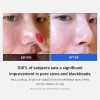 Medicube All-inclusive Skincare Collection