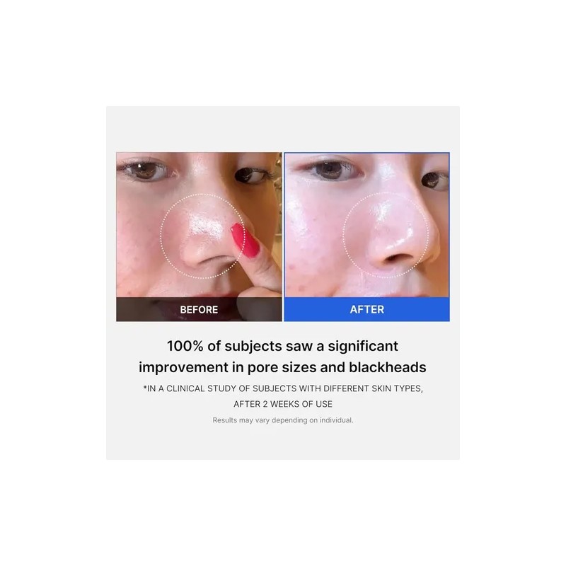 Medicube All-inclusive Skincare Collection